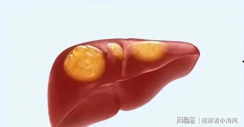 肝脏吃瓜,探寻肝脏与瓜类食材的奇妙关系